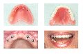 1dentist - протезирование за 1 день в Москве